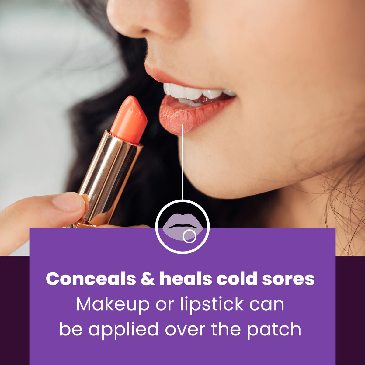 15 Hydrocolloid Cold Sore Patches X51758