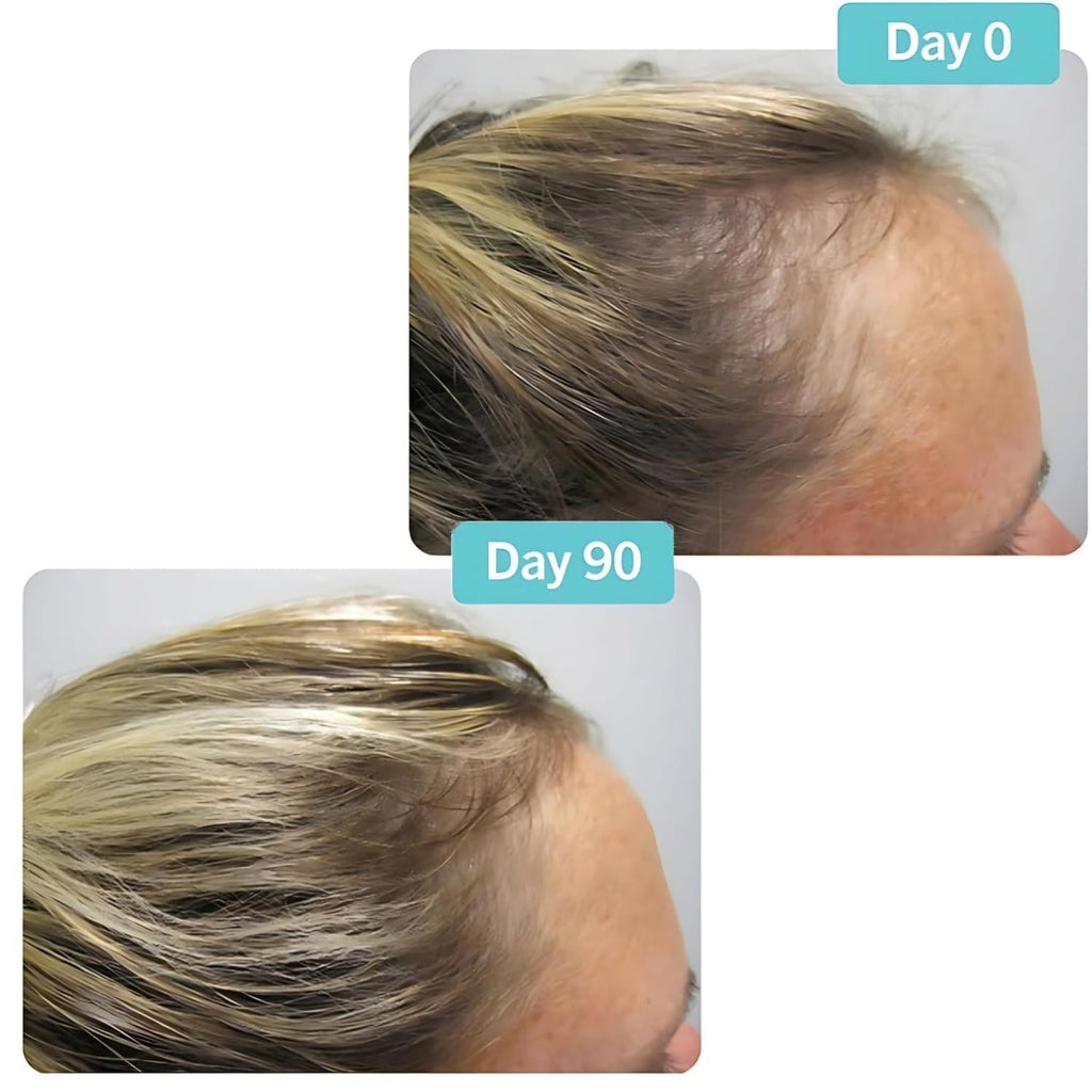 Hair Growth Supplement 180 Tablets E49895