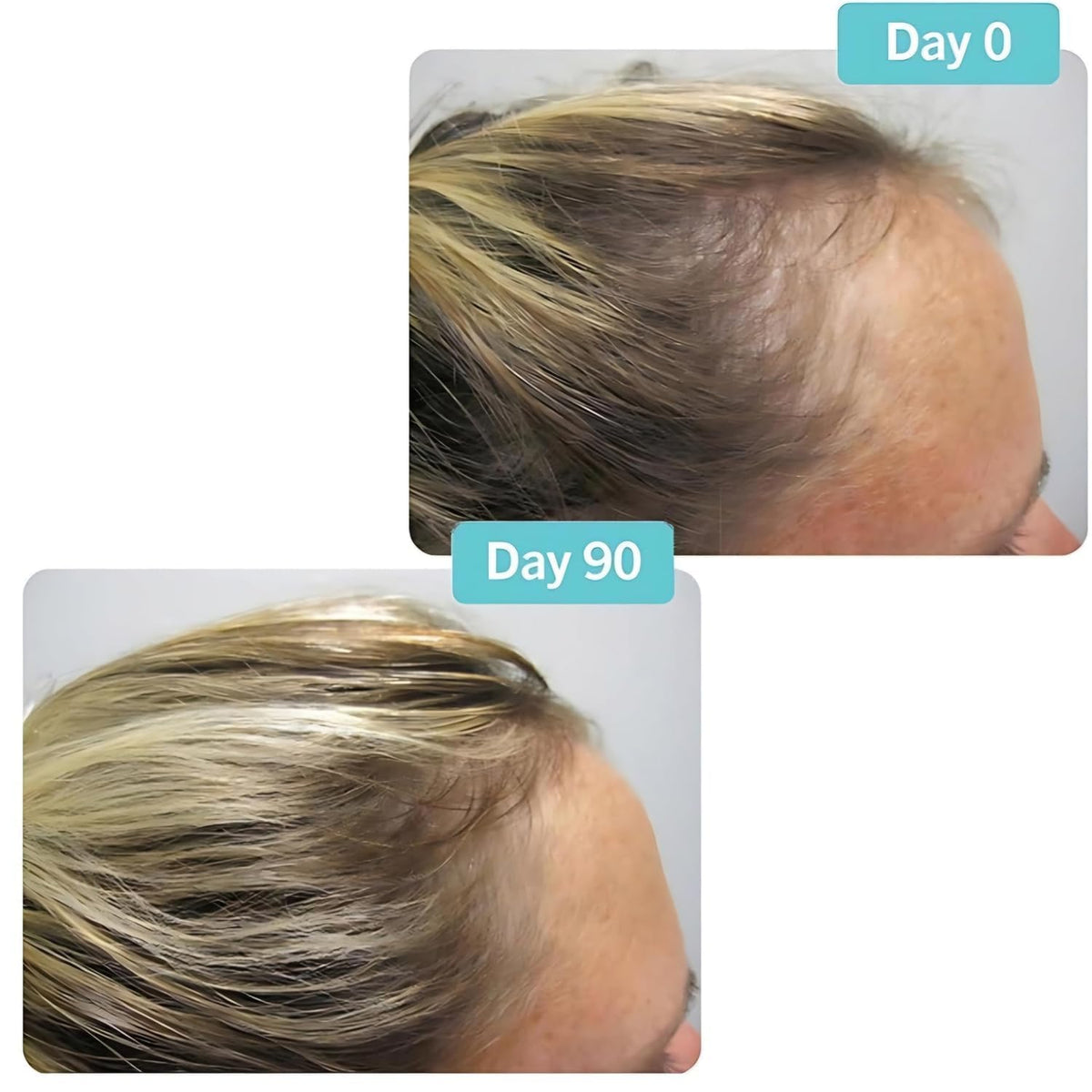 Hair Growth Supplement 180 Tablets E49895